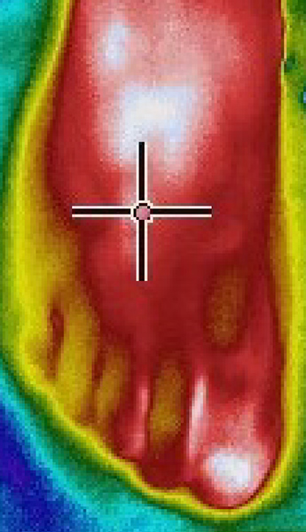 浸漬から10分後右足